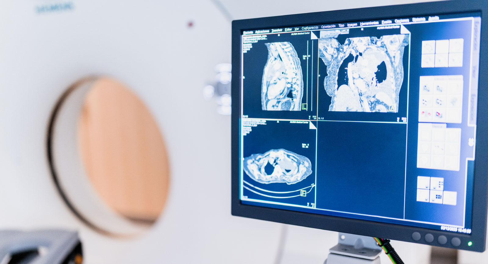 AI-Radiologie-Dashboard — DICOM-Analyseoberfläche